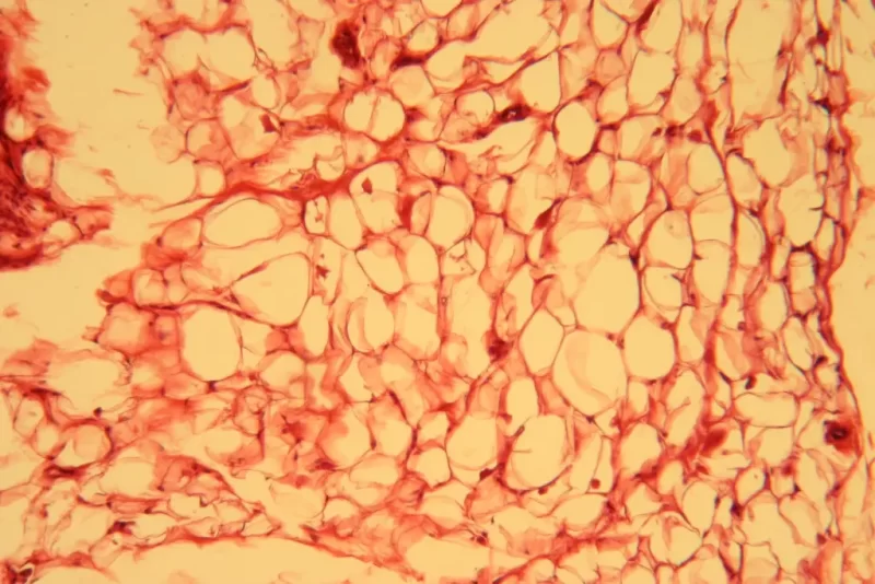Adipose tissue