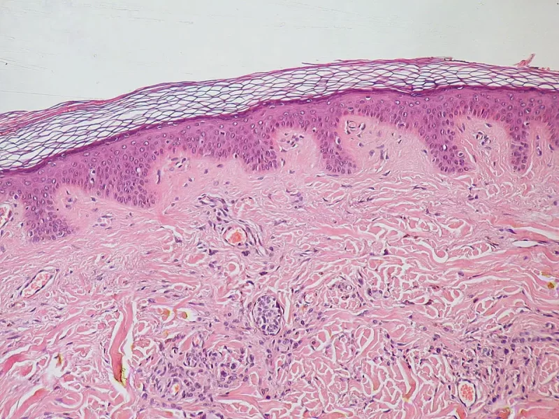 Loose connective tissue
